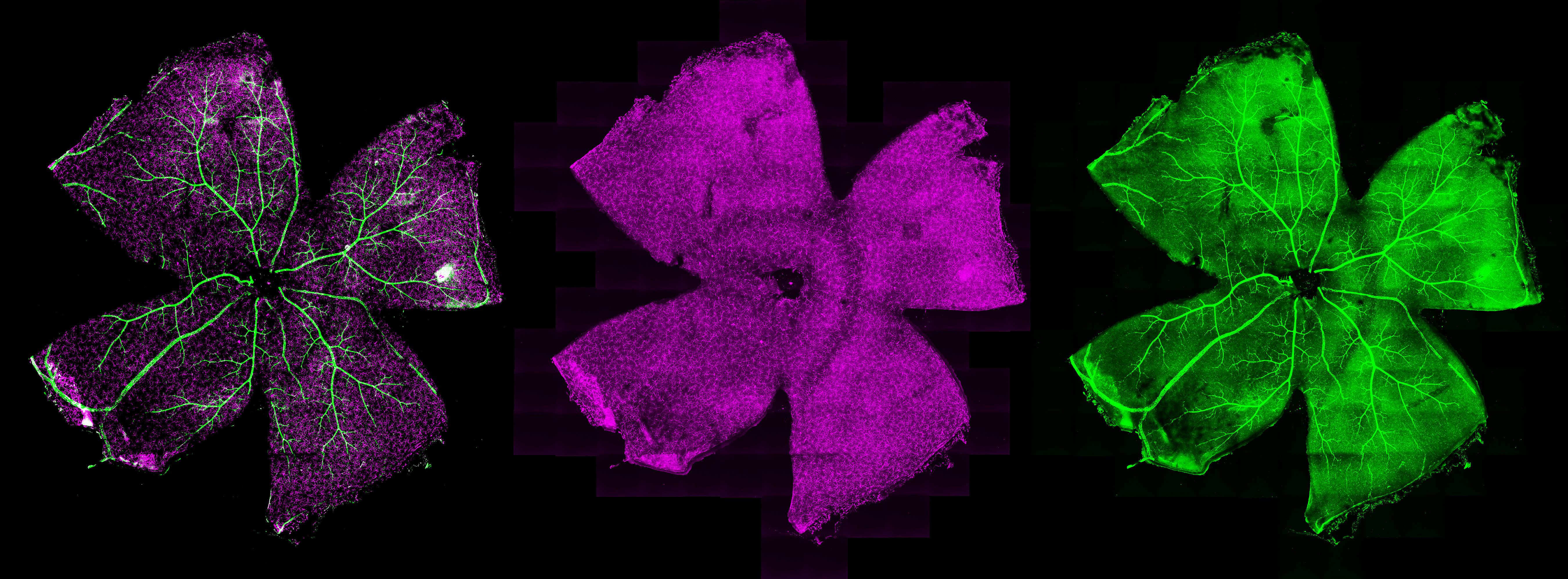 A confocal microscope image of a flatmounted mouse retina labeled by ganglion cells (fuschia) and vasculature (green).