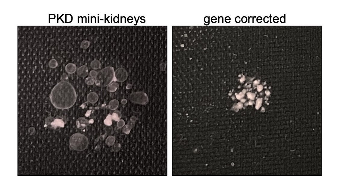 Two models of kidney disease