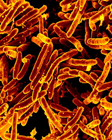 Photo of bacteria that causes TB