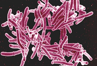Photo of bacteria that causes TB