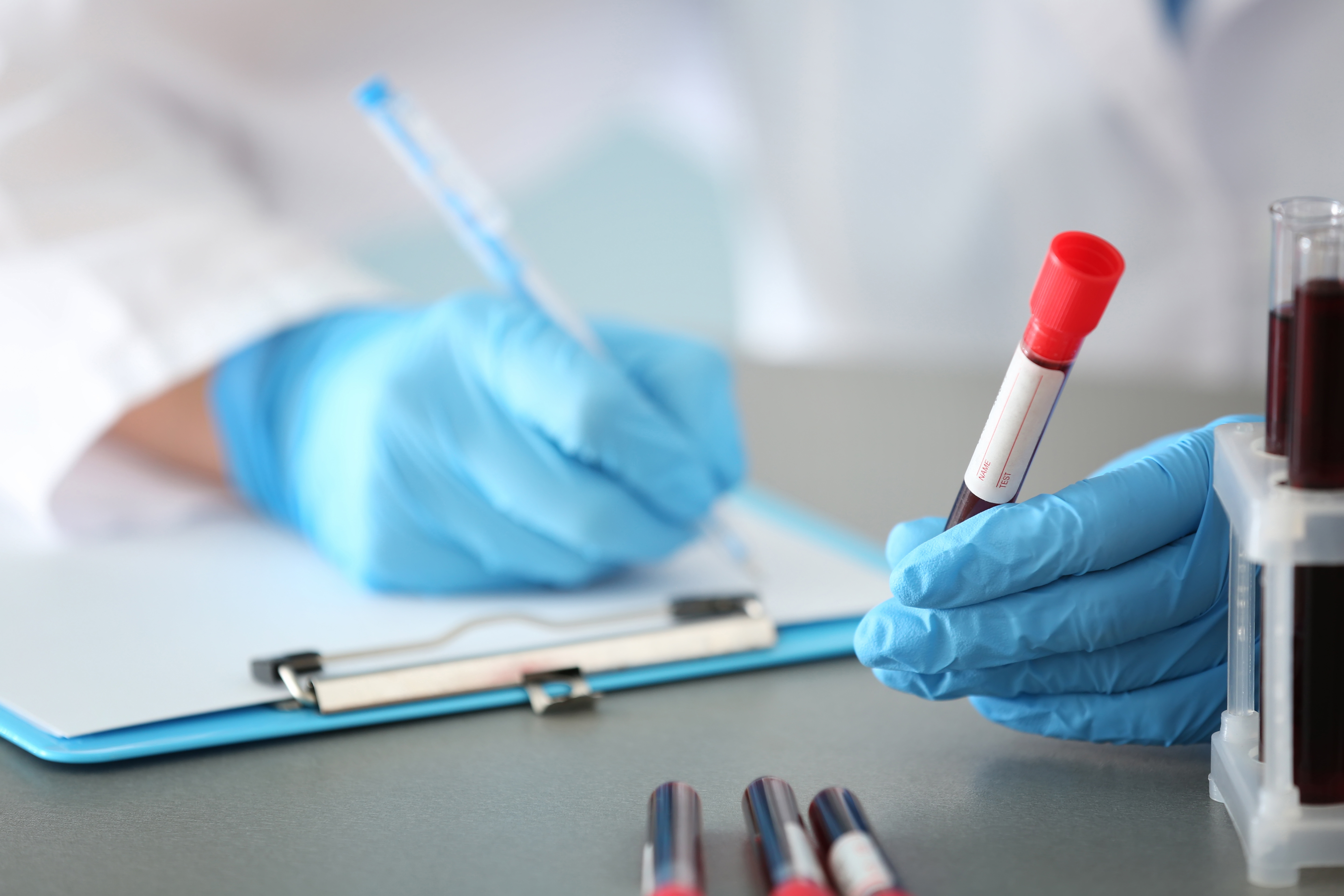 Scientist's gloved hands are visible writing note on a clipboard while holding test tube of blood