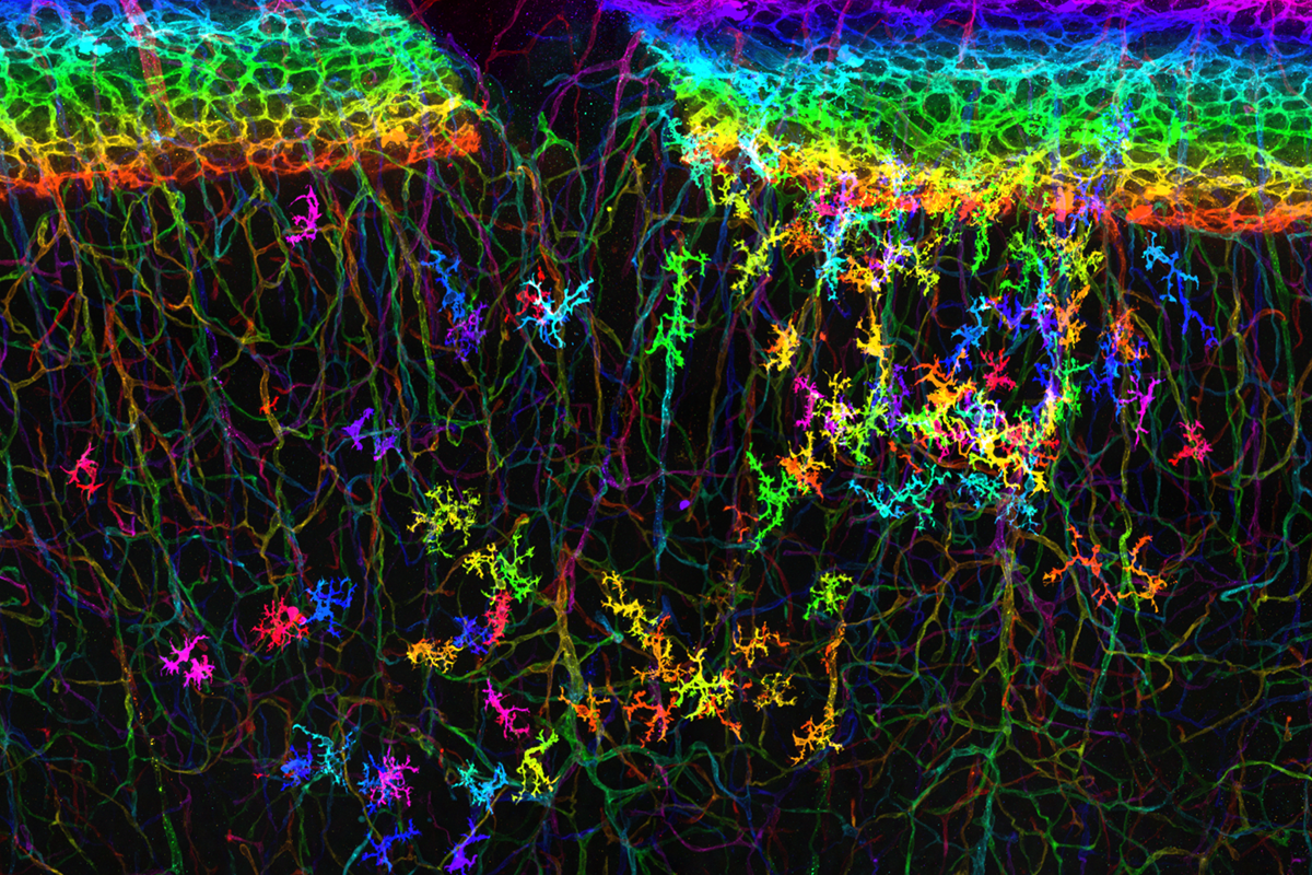 Microglia intertwined with tiny blood vessels
