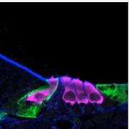 btl-social-sensory-hair-cells.png