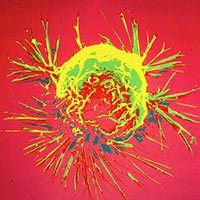 Cancer Biology