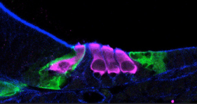 cj-2024-sensory-hair-cells-in-pink.png