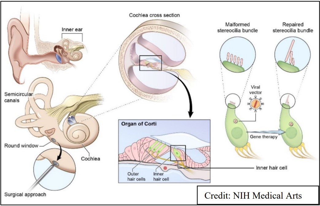 ear-diagram.jpg