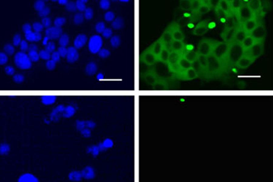 Huntington cells
