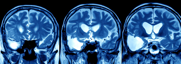 img_focus_on_traumatic_brain_injury_634x226.jpg