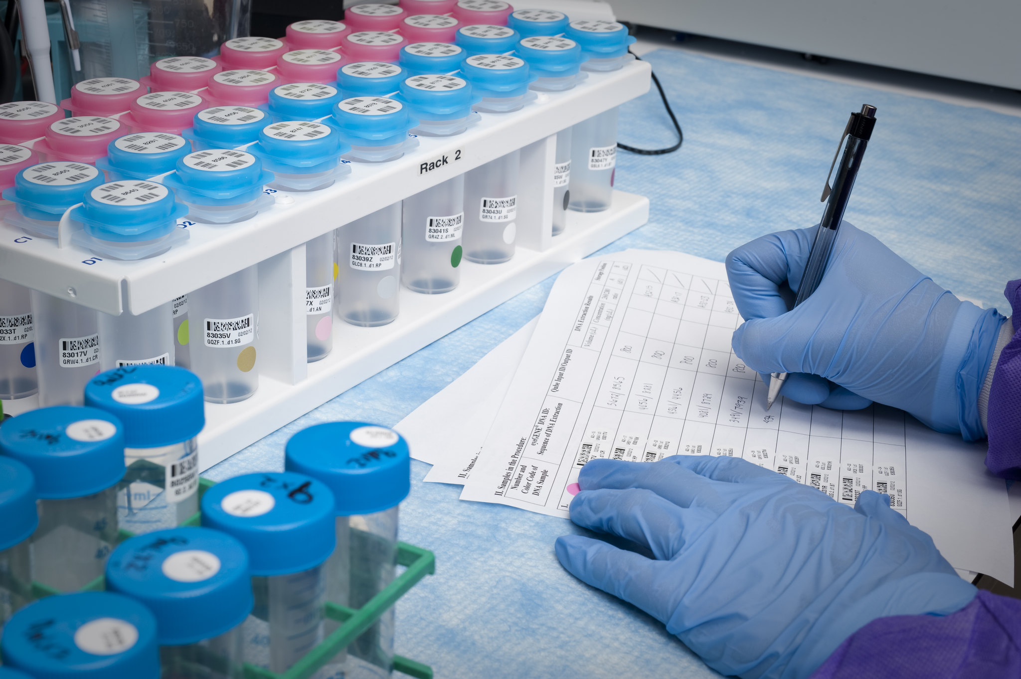 A National Eye Institute laboratory scientist documents research findings.