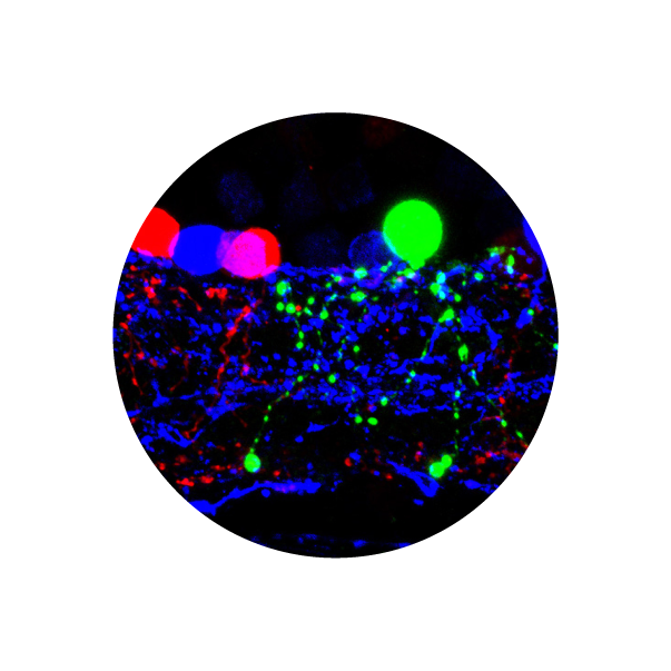microscopic photo 
