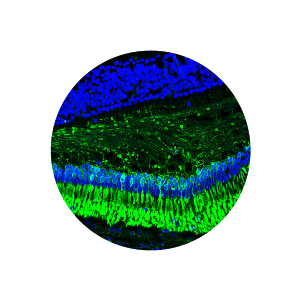 microscopic photo 