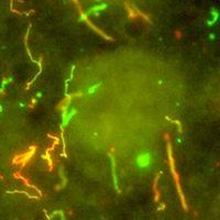 Microbiology and Infectious Diseases