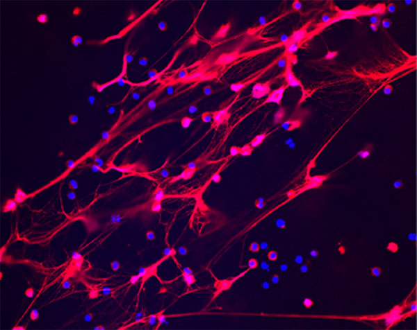 Color image of neutrophil traps