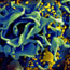 View of HIV under microscope