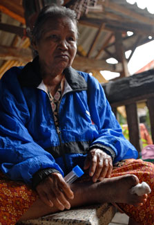 Older woman seated on an outdoor platform looking off camera holds medication bottle, injured foot visible with bandaged toe