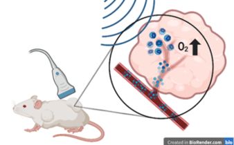 Drawing of a mouse receiving an ultrasound which increases the oxygen level in the tumor