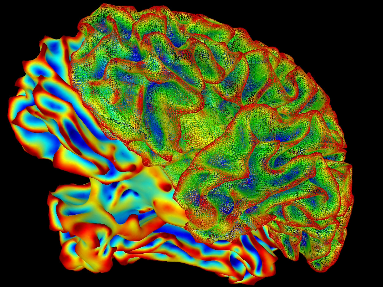 Colorful brain scan of individual, part of the mysterious BRAIN Initiative.
