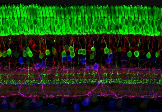 Microscopic image of ground squirrel retina and cone receptors in the top layer