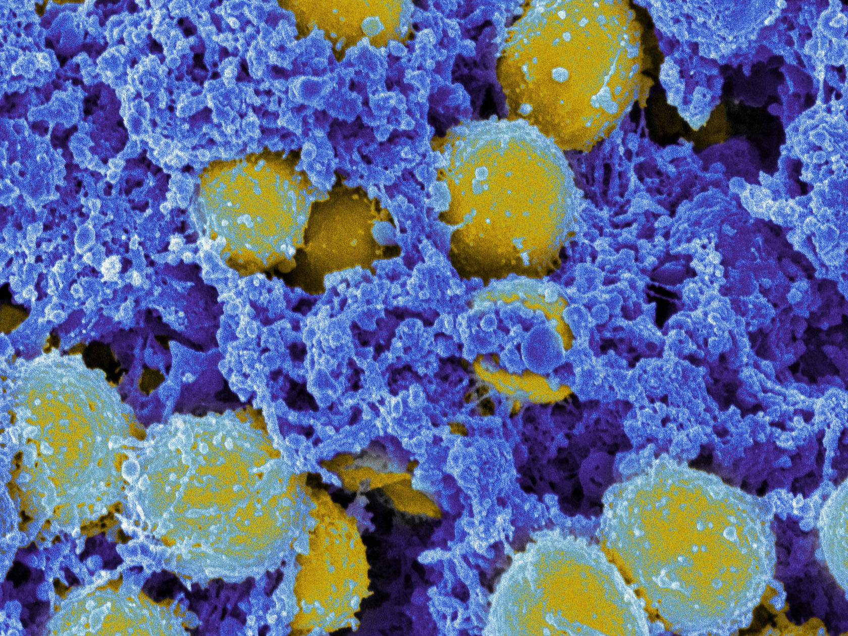 Scanning electron micrograph of&nbsp;Staphylococcus aureus bacteria.