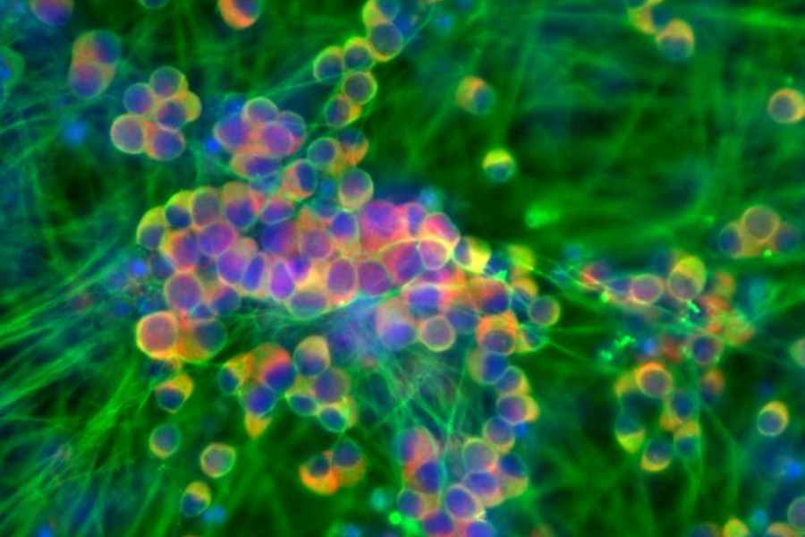 Pain-receptor neurons stained green and red to show cellular activity.