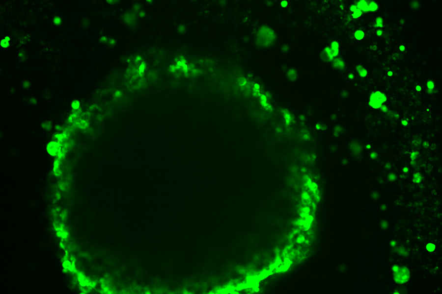Image shows differences in cell layers’ fluorescent-dye uptake in a model of high-grade serous ovarian cancer.