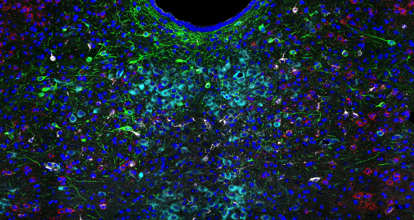 Image from an RNAscope and immunostaining experiment to detect VGluT2, Fluoro-Gold, TPH, and TH in the dorsal raphe