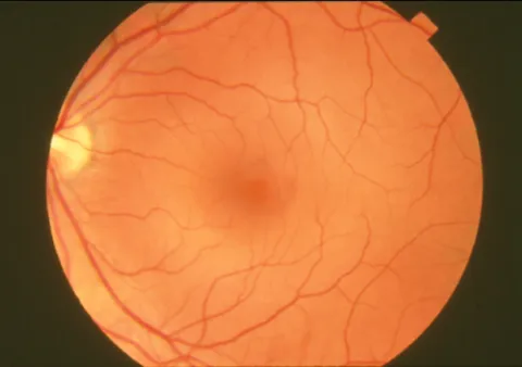 all-of-us-funding-prs-eyes-on-health.jpg
