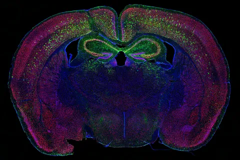 brain-funding-opportunities.jpg