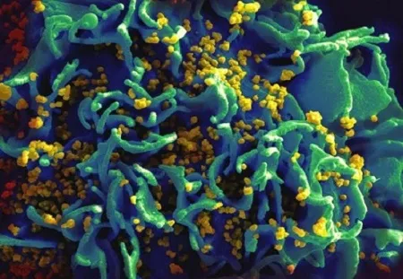 HIV-infected T cell