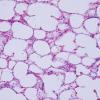 Histology image of human lung tissue