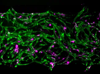 Magnification of an engineered bone marrow-on-a-chip includes a network of green-labeled blood vessels and patches of magenta-labeled cellular niches   