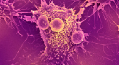 cancer genetics