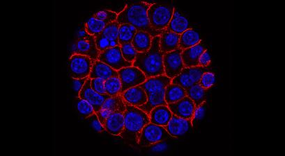 Pancreatic Cancer Cells