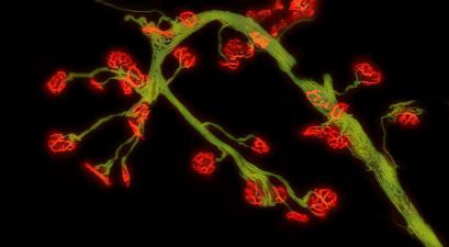 Leg Muscle from Mouse Model of Pompe Disease