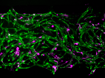 Magnification of an engineered bone marrow-on-a-chip includes a network of green-labeled blood vessels and patches of magenta-labeled cellular niches &nbsp;&nbsp;