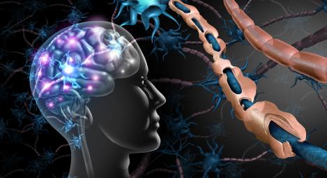 Depiction of deteriorating myelin sheaths in the brain