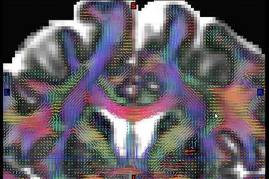 Human Connectome Project