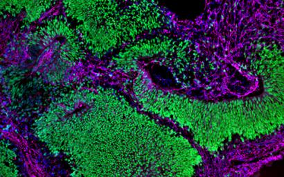 Brain organoid depicting neural stem cells (green) and neurons (magenta).