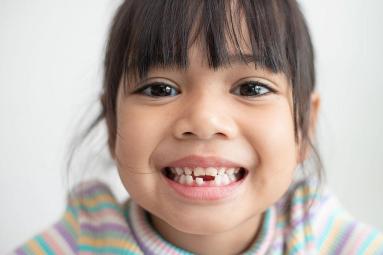 a young child with a missing tooth