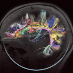 Map of the wiring diagram of specific brain circuits, now called the 'connectome' in the human brain
